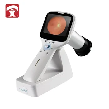 HD офталмологичен инструмент Цифров преносим ръчен очен фундус камера Оптично оборудване Ръчно изображение с висока разделителна способност HFC-100